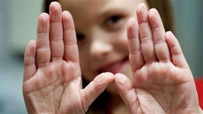 دراسة حديثة: كيف تعرف أنك مصاب بفيروس كورونا من أصابع اليدين؟