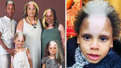 برازيلي وأسمر.. رحلة صبي من التنمر إلى أشهر عارض أزياء 