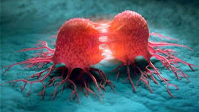 4 أطعمة قنبلة موقوتة في المنزل.. قد تصيبك بالسرطان