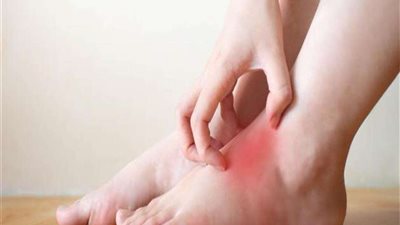 مشروبات سحرية للتخلص من الأملاح في الجسم