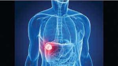 احذر هذه الأشياء للحفاظ على  صحة الكبد.. اعرف التفاصيل