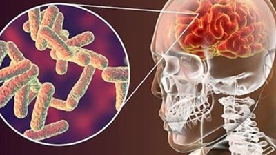 الحكومة تكشف حقيقة انتشار حالات إصابة بوباء الالتهاب السحائي بين طلاب المدارس