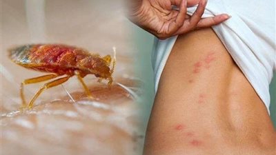 تسبب لنا الخطر.. احذر تلامس هذة الكائنات الدقيقة