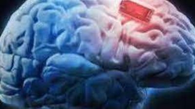 على طريقة اللمبي 8 جيجا.. شريحة للمخ تعيد النظر وتعالج الشلل