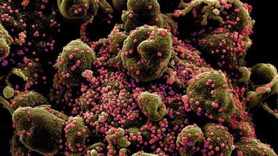 خبراء يكشفون أسرار جديدة بشأن قضاء كورونا على نفسه