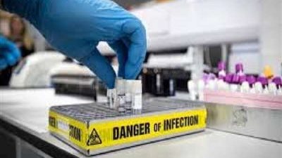 بشرى سارة.. المسؤول عن تمويل اللقاح الروسي يكشف موعد طرحه