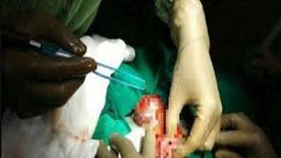 تفاصيل صادمة.. فتاة تمزق بطن صديقتها الحامل وتسرق طفلها (صور)