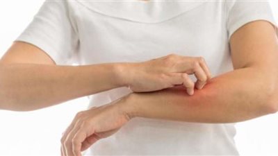 طبيب يكشف طريقة للقضاء على جفاف الجلد