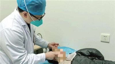 مشجع صيني  يصاب بالشلل بسبب كأس العالم .. تفاصيل