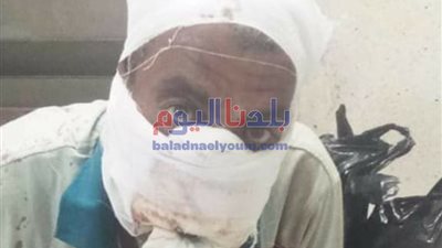 حبس إثنين متهمين مشتركين فى قطع أنف وشفاه رجل بالمحلة (صور)