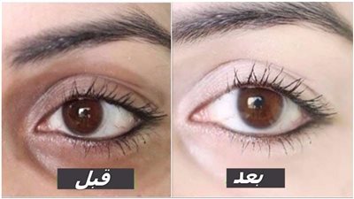 عادات خاطئة تسبب ظهور 