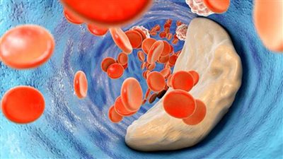 ثلاث أمراض تسبب تدهور الصحة بعد الإصابة بفيروس كورونا