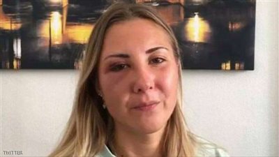 اعتداء مشين على امرأة من قبل 3 رجال .. والسبب 