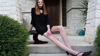 صاحبة أطول ساق في العالم.. تحطم رقمين قياسيين في جينيس (صور)