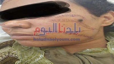 رجل يقطع جسد طليقته أمام ابنته ويصيب مناطق حساسة (صور)