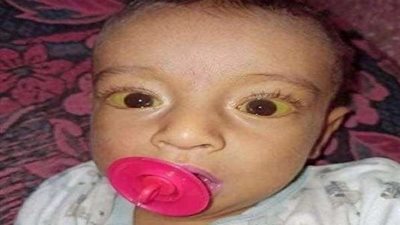 مجلس الوزراء يتدخل لإنقاذ طفل مصاب بالكبد في الفيوم