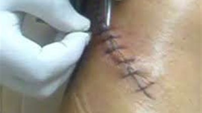 إصابة طالب بجرح قطعي في البطن على يد زميلة بالجيزة