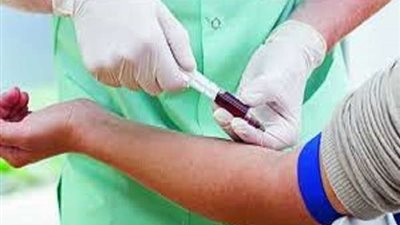 أطباء يكشفون عن مفاجأة بشأن علاج فيروس سي وعلاقته بكورونا