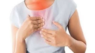 أسباب و طرق علاج ارتجاع المرئ