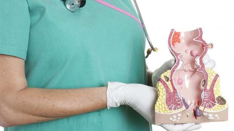 أمراض الشرج والمستقيم