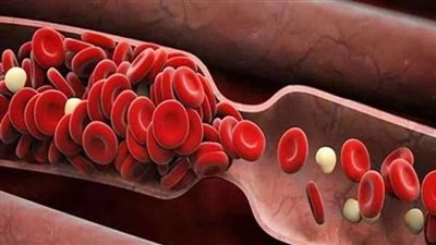 أفضل 5 أطعمة يمكن تناولها لتجنب الإصابة بأمراض القلب