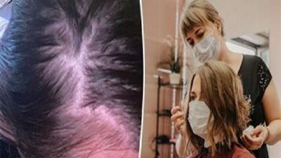 متعافية من كورونا تكشف العلاقة بين الفيروس وصبغة الشعر