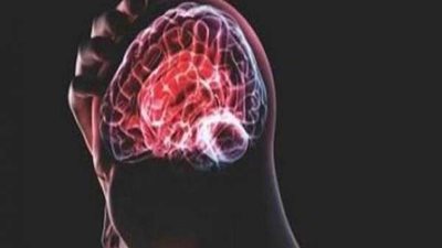 استشاري يوضح الفرق بين اضطراب الشخصية والمرض النفسي