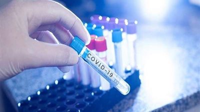 روسيا تعلن أخبار سارة عن لقاح 