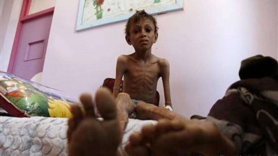مجاعة وشيكة في اليمن.. الأمم المتحدة تحذر العالم
