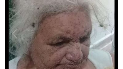 شاهد.. ماذا حدث لمسنة تعرضت لآلاف اللدغات من سرب نحل ضخم؟