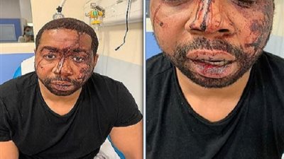 الشرطة تعتدي على منتج شهير بسبب عدم ارتدائه الكمامة