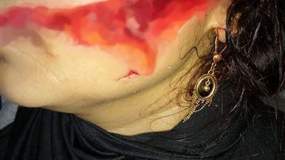 نار الغيرة.. موظف يمزق جسد طليقته بطنطا