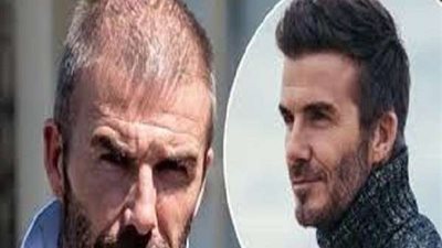 شاهد.. كيف تحول وجه بيكهام بعد إصابته بالملاريا؟