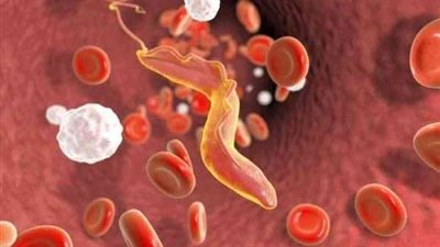 بالصدفة.. سيدة تكتشف ديدان في طعام طفلها والسبب