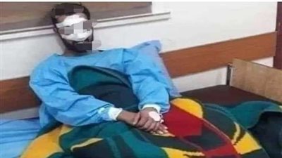 قطعت أنفه.. سيدة تنتقم من زوجها لهذا السبب