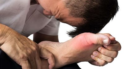 مشروب سحري يحارب النقرس وهشاشة العظام