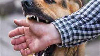 كلب يعقر محاسبا وشقيقته في الجيزة