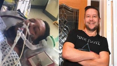 دراسة: فيروس كورونا يؤثر على العقل