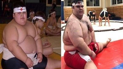 الموت يغيب أكبر طفل في العالم... والسبب مجهول