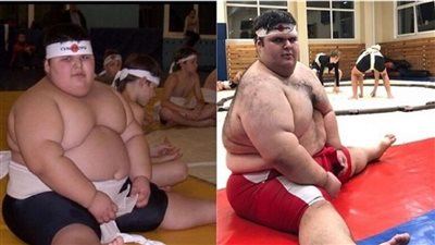 وفاة أضخم طفل في العالم عن عمر 21 عاما