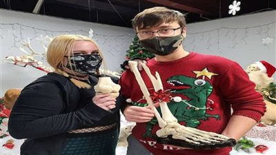 بعد بترها في حادث.. شاب يقرر تحنيط ساقه والسبب مفاجأة