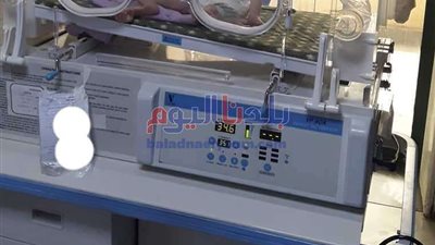 جراحة نادرة لطفلة تعاني من انسداد في فتحتي الأنف بمستشفى المحلة