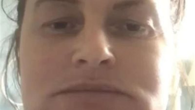 كارثة تجميلية.. فتاة تتحول إلى رجل الفيل