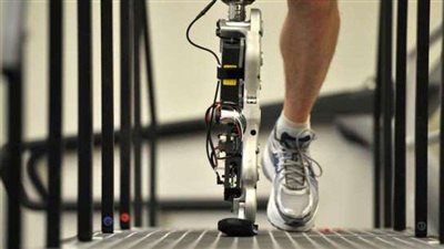 التضامن: نستعين بخبرات أجنبية لإنتاج الأطراف الصناعية