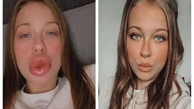 شاهد.. التحول المرعب لـ