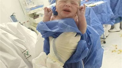 سيدة مصابة بفيروس كورونا تخضع لـ عملية ولادة قيصرية ناجحة.. وتنجب توأم بالشرقية