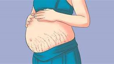 مفيدة شيحة تكشف طريقة ذهبية للتعامل مع علامات العجز والسيلوليت