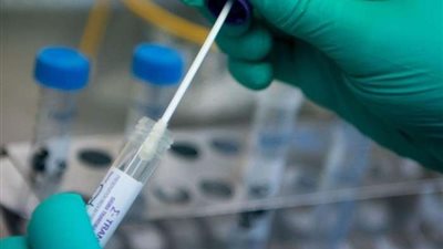 مستشار الرئيس للصحة يحسم الجدل بشأن تعميم 