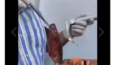 صدق أو لا تصدق.. شاب يبتلع سمكة طولها سبع بوصات