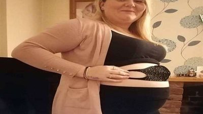 أم تكتشف مفاجأة مذهلة بعد إجراءها أشعة 